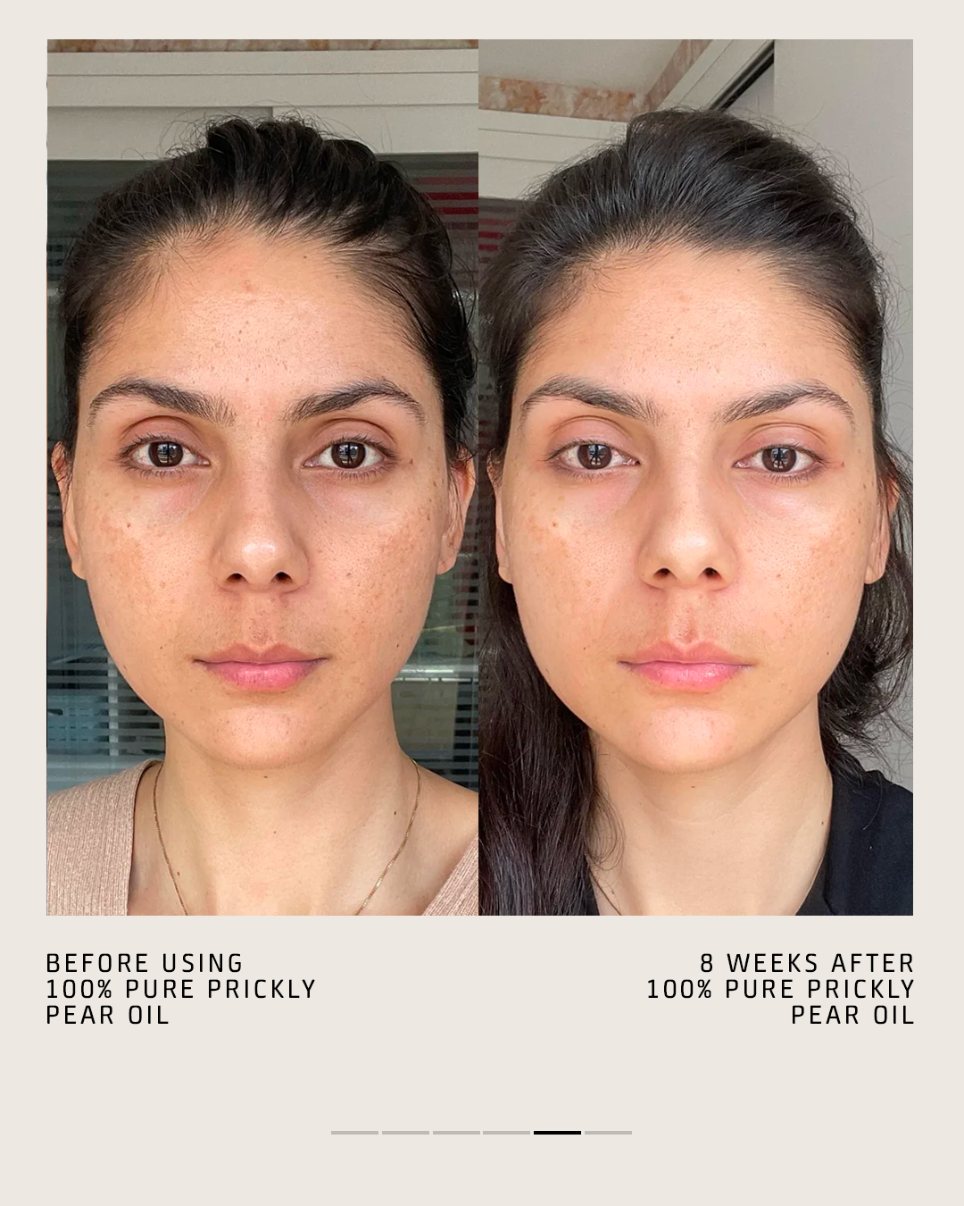 100% PURE PRICKLY PEAR OIL