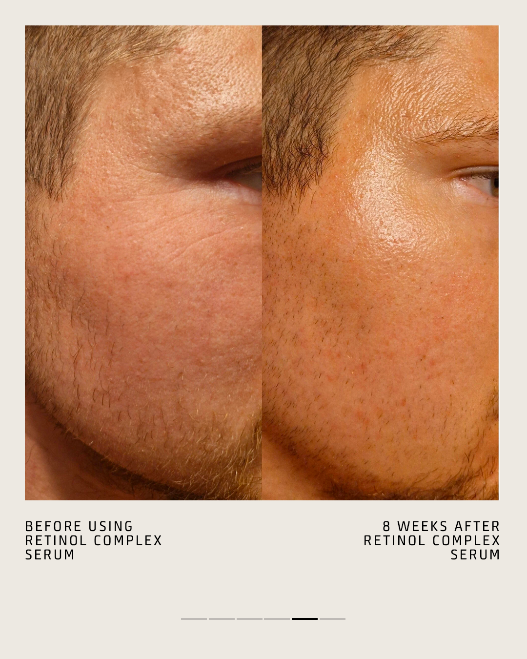 RETINOL COMPLEX SERUM