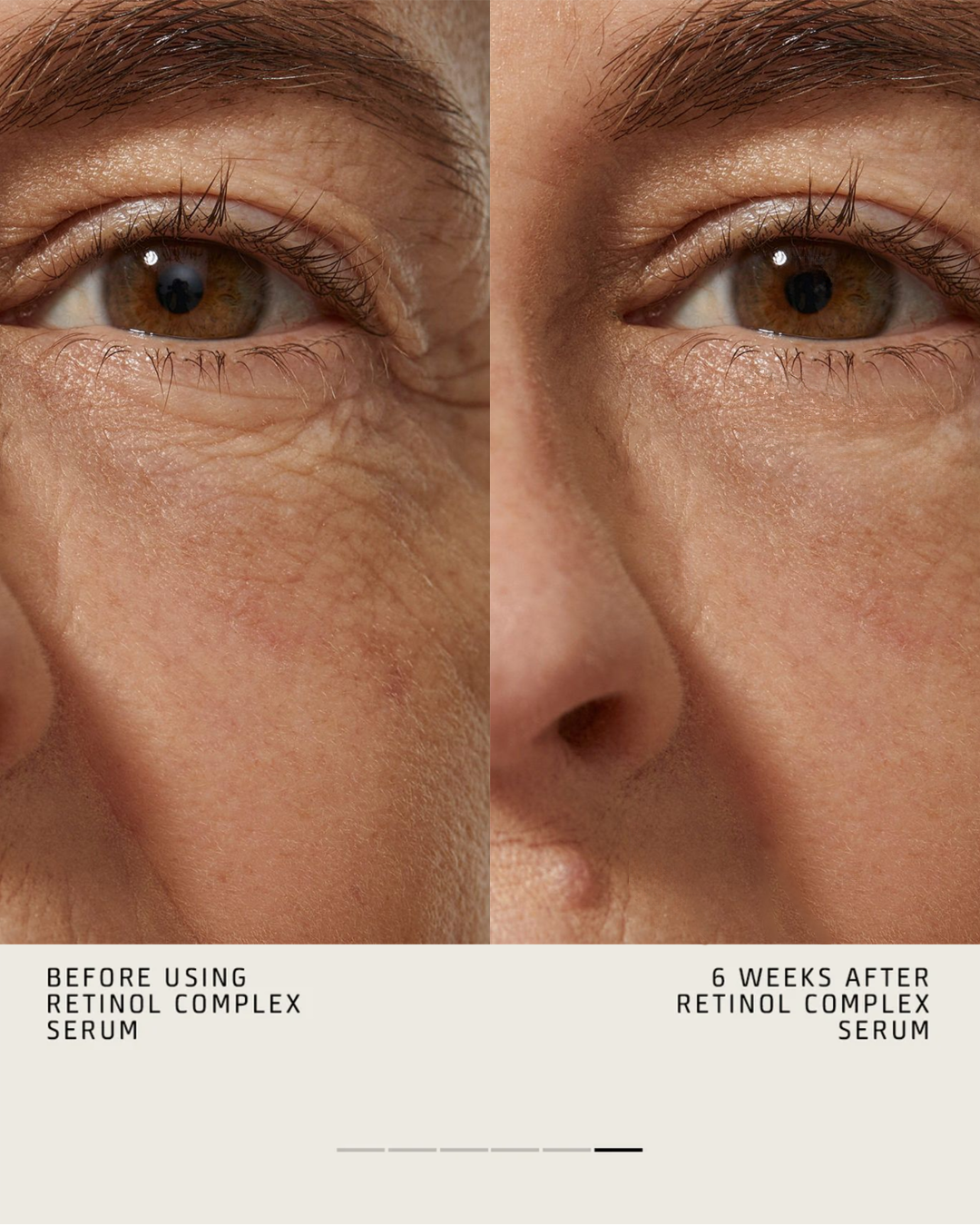 RETINOL COMPLEX SERUM