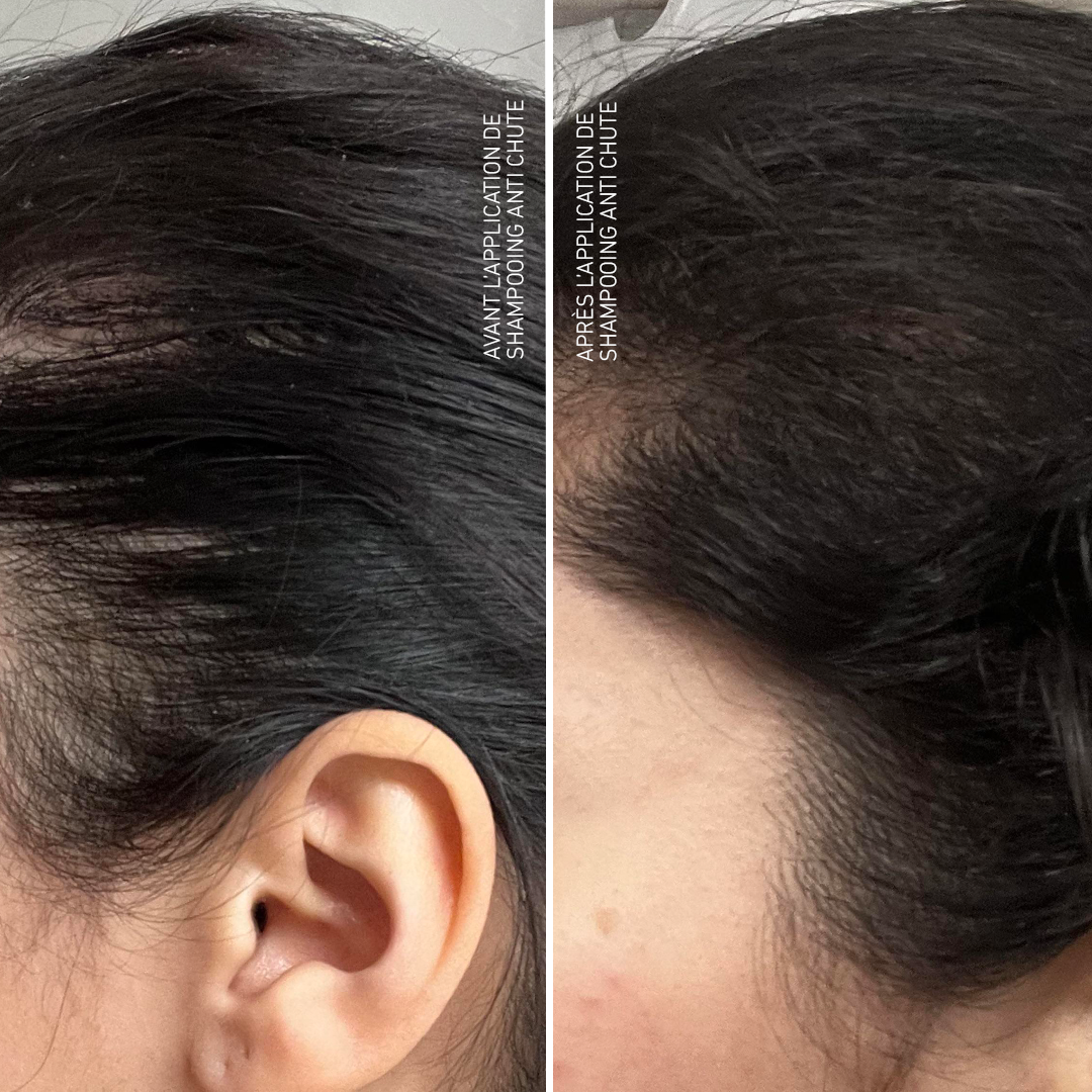 Shampooing Anti chute