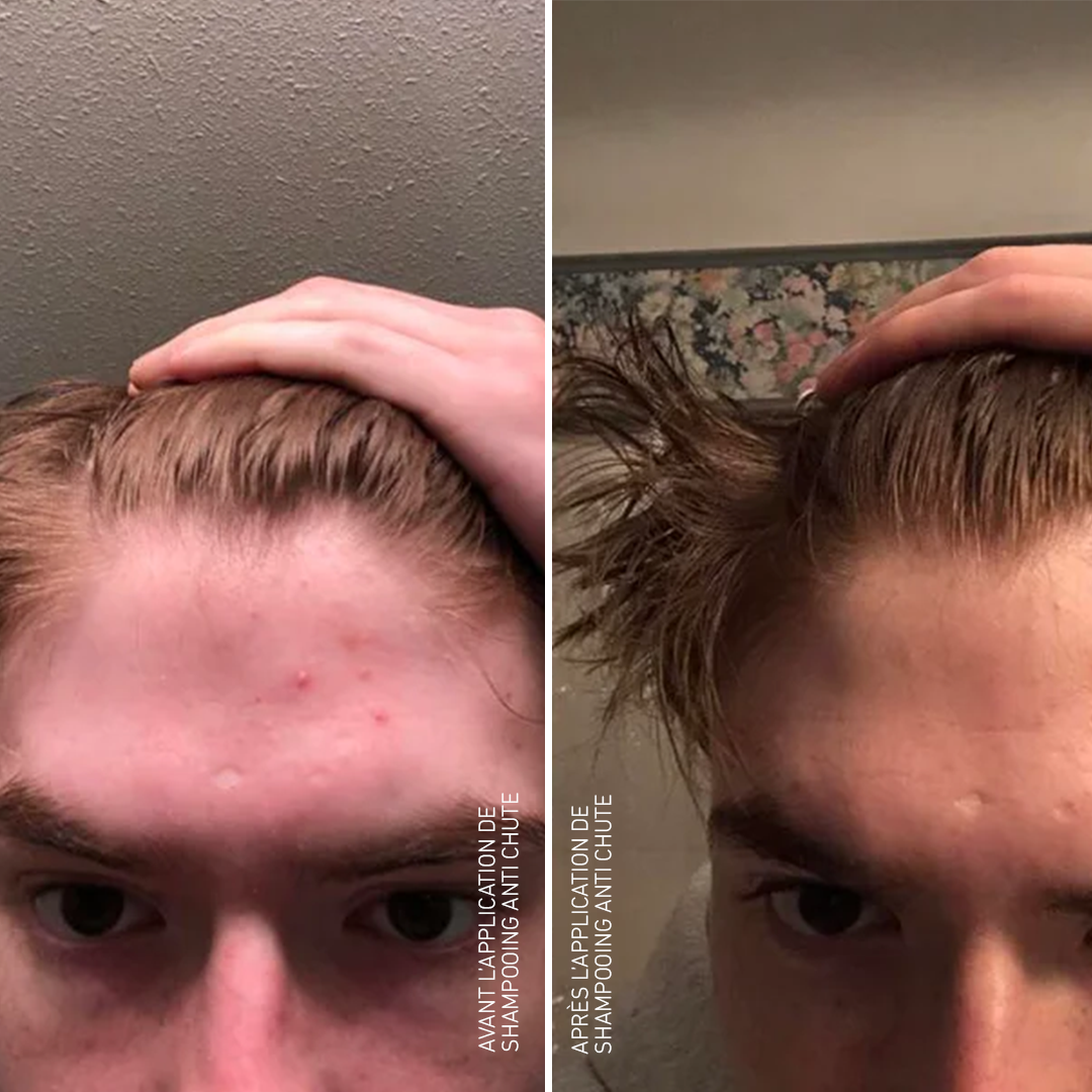 Shampooing Anti chute