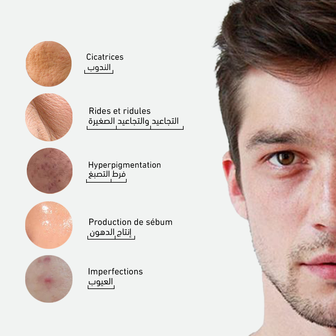 Pack Anti-Imperfections