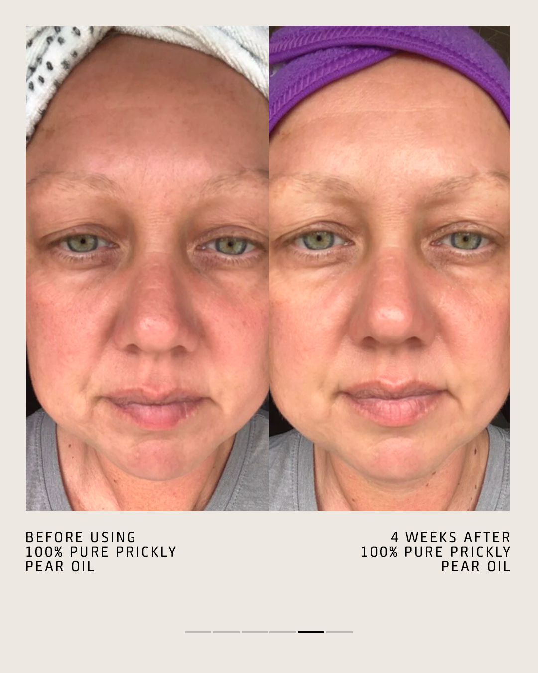 100% PURE PRICKLY PEAR OIL