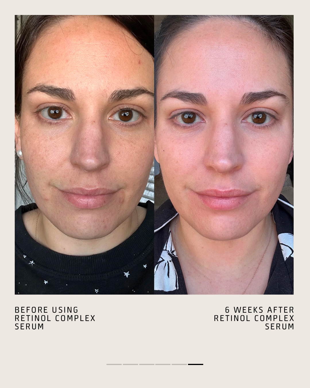 RETINOL COMPLEX SERUM