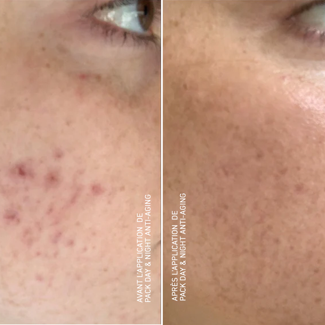 Day & Night Anti-Aging