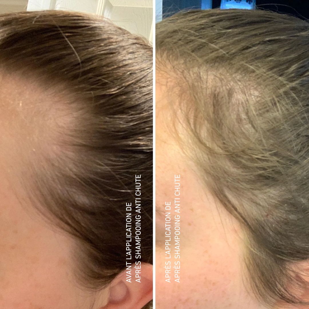 Après Shampooing Anti Chute